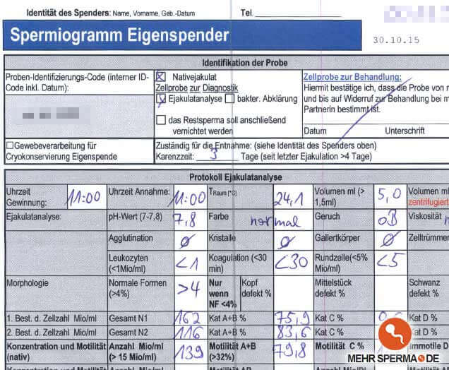 Spermiogramm nach Volume 500 Einnahme