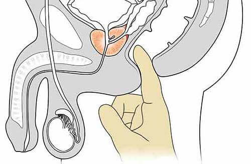 Anleitung Prostatamassage